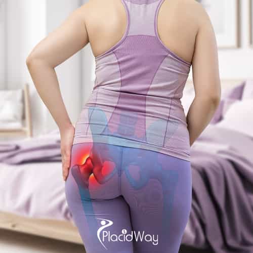 Minimally Invasive Hip Replacement in Istanbul: Booking to Recovery Guide for UK Patients